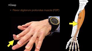 Forearm flexor muscles [upl. by Ydnelg]