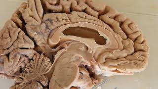 Human Neuroanatomy Detailed Brain 3D Animation  Structure and Function [upl. by Relyhcs]