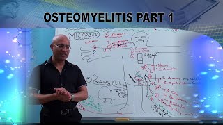 Osteomyelitis  Causes amp Symptoms  Bone Infection🩺 [upl. by Htirehc]