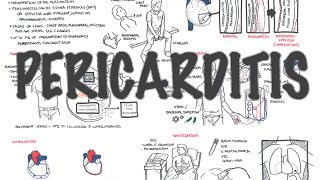 Pericarditis  Overview signs and symptoms pathophysiology diagnosis treatment [upl. by Sacul]