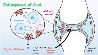 Gout  Mechanisms amp Treatment [upl. by Mcconaghy]