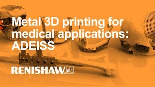 Metal 3D printing for medical applications ADEISS [upl. by Hseham]