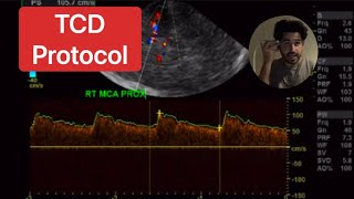 TCD Protocol Transcranial Doppler [upl. by Tiffany]