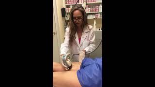 VelaShape NYC amp VelaShape III Fat Removal Treatments [upl. by Renard]