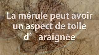 Comment reconnaître la Mérule PAMI votre expert du traitement anti termites [upl. by Mond982]