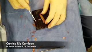 Rib Cartilage Carving  Live Surgical Footage for Rhinoplasty [upl. by Roinuj]