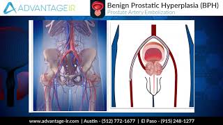 Coronary Angiogram Full Length Procedure [upl. by Wohlen]