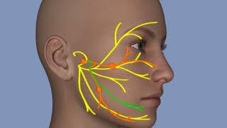 Bells Palsy and Stroke [upl. by Yarehs577]