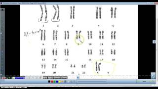 Karyotype analysis [upl. by Jankell788]