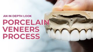 Porcelain Veneers A Dental Boutique Process  An In Depth Look [upl. by Ecineg]