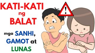 Gamot sa KATI KATI sa BALAT  Epektibong Ointment Halamang Gamot at iba pa para sa makating BALAT [upl. by Arinayed]