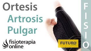 Artrosis del pulgar  Cómo cuándo y por qué utilizar ortesis [upl. by Bust]