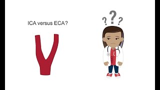 Distinguishing the ICA from the ECA with ultrasound [upl. by Ely500]