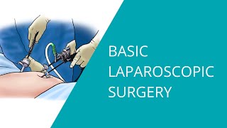 Basic Laparoscopic Surgery [upl. by Musetta]