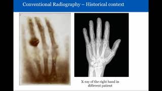 Introduction to Radiology Conventional Radiography [upl. by Nilerual6]