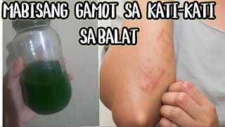 MABISANG GAMOT SA KATI KATI SA BALAT  SUGAT AT MGA GALIS [upl. by Darell]