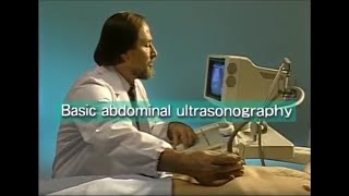 How to do abdominal ultrasound examination [upl. by Nehttam]