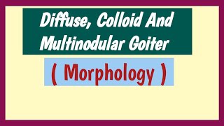 Total Thyroidectomy Massive Multinodular Goiter by Dr Danielle M Hari [upl. by Lucina]