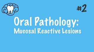 Oral Pathology  Mucosal Reactive Lesions  INBDE ADAT [upl. by Cob]