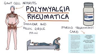 Learn how to manage Rheumatoid Arthritis pain [upl. by Paloma]