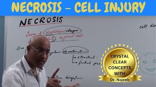 Necrosis  Cell Injury  General Pathology 🩺 [upl. by Yekcim323]