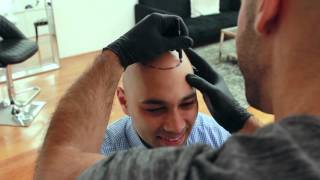 Inside Look Scalp Micropigmentation Treatment  Scalp Micro USA [upl. by Enortna]