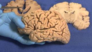 Anatomy of the Brain  Dissectible Model [upl. by Greenburg810]