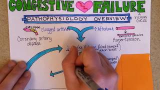 Congestive Heart Failure Pathophysiology [upl. by Beverley]