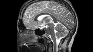 Introduction to Neuroanatomy Ventricular System and CSF Dr Adel Bondok [upl. by Assilram]